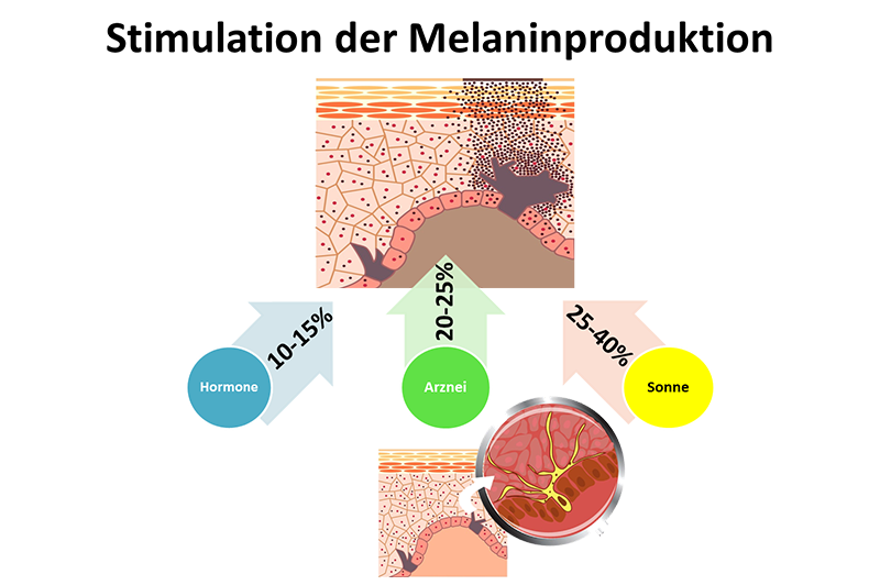 Was Ist Melanin Einfach Erklärt 7a Stimulation der Melaninproduktion - Praxis Juri Kirsten