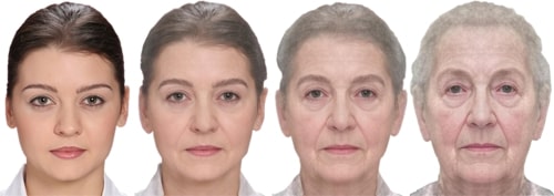 Gesichtsveränderung durch das Altern