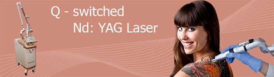 Q-Switched-ND-YAG-Lasertechnologie-für-dei-Tattooentfernung-Berlin